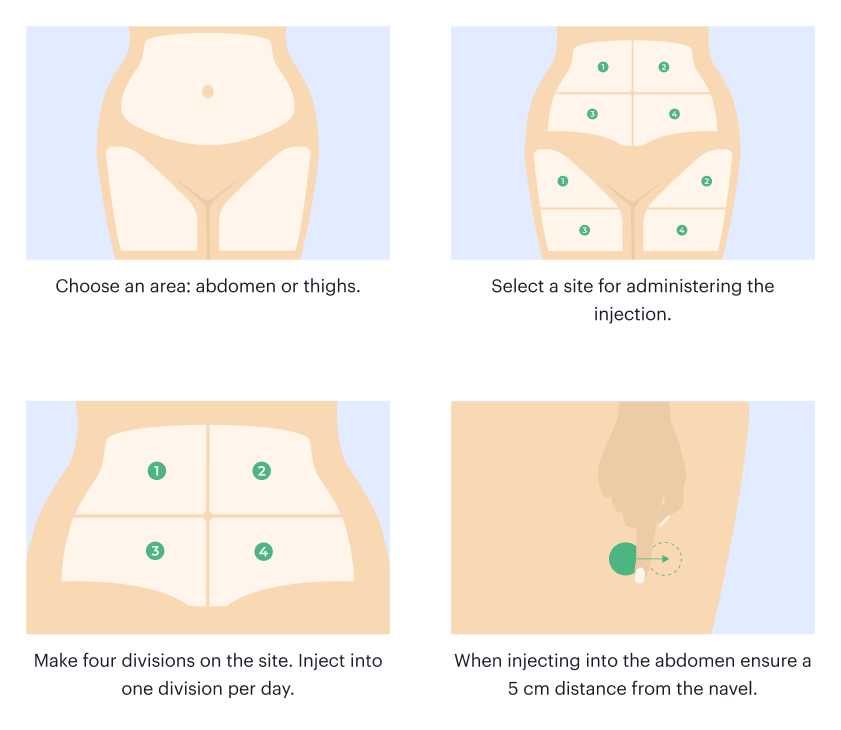 Where should I inject Mounjaro